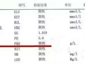 尿蛋白的(de)檢查怎麽看?
