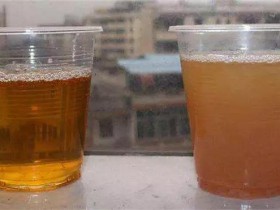 尿中帶血,可(kě)能是這(zhè)9大(dà)原因!
